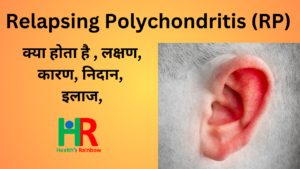 50. Relapsing Polychondritis