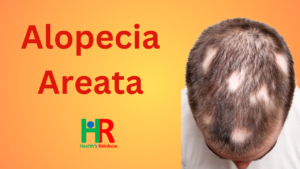 Alopecia