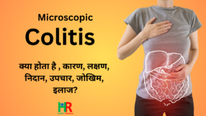 Colitis