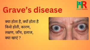 Grave's disease