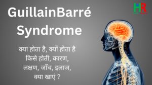 GuillainBarré Syndrome