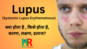 Lupus