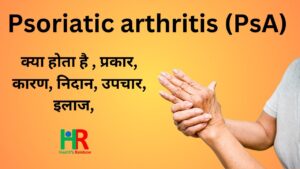 psoriatic arthritis