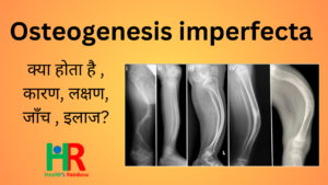 Osteogenesis imperfecta