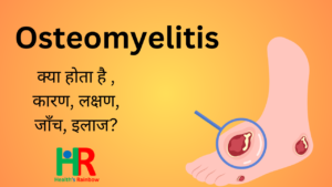 Osteomyelitis