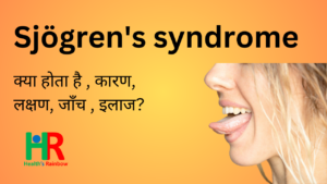 Sjogren syndrome