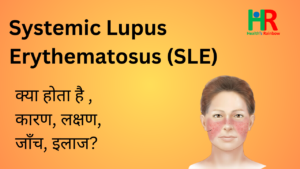 Systemic Lupus