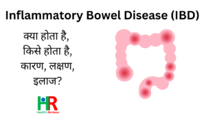 IBD Disease