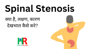 SPINAL STENOSIS